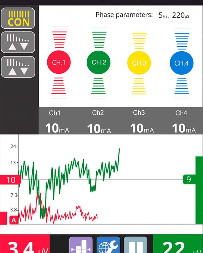 Myoplus Neurotrac 4 Pro electromiografía