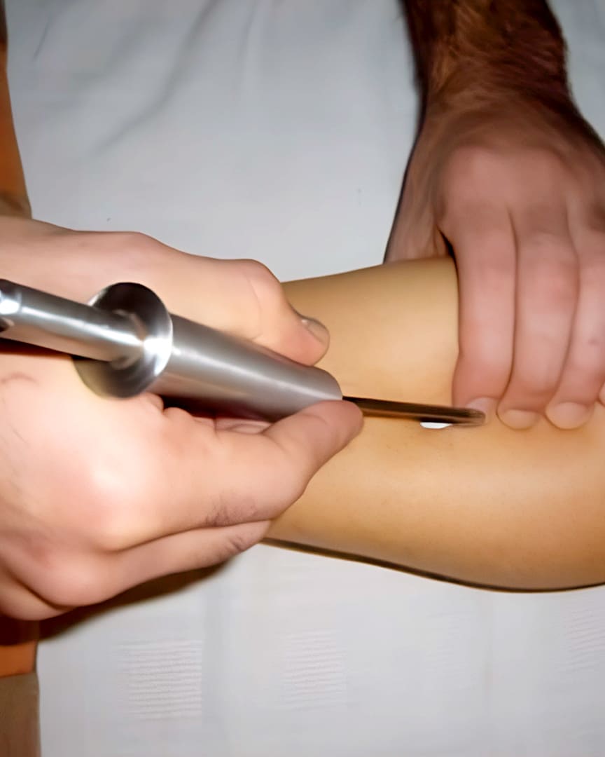 Gancho fibrólisis diacutánea de fisioterapia