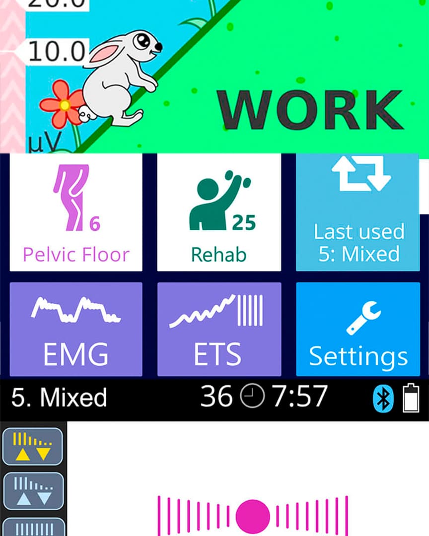 Neurotrac Pro Myoplus electromiograma